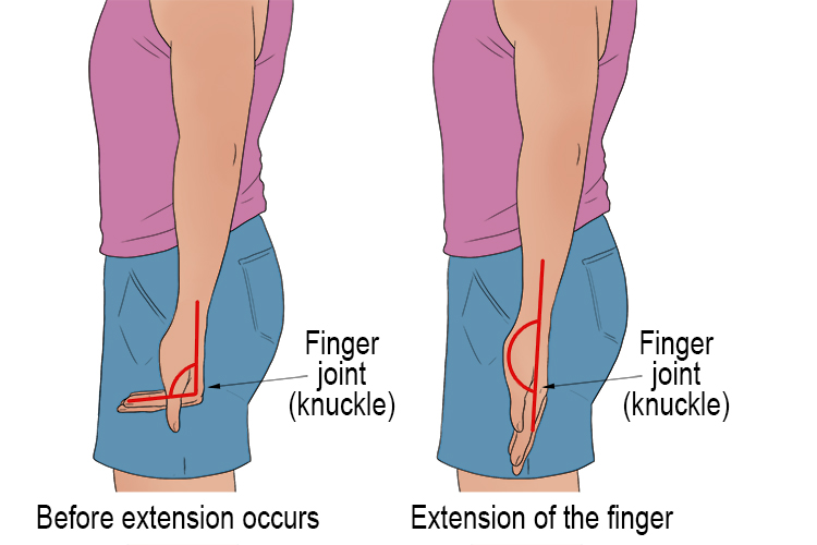 Finger extension occurs when the angle between your fingers and the palm of your hand increases.
